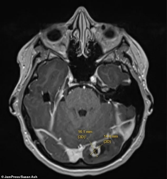 New Mother's Vision Flashes Lead to Devastating Brain Tumor Diagnosis