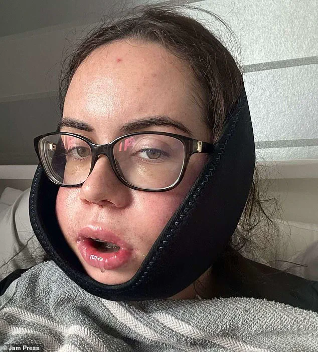 Luisa McDermott's 10-Year Jaw Surgery Battle: Emotional TikTok Series Exposes Struggles and Triumphs
