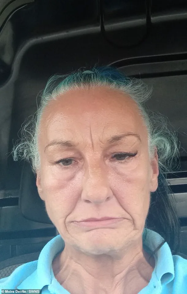 A Mother's Disfigurement: The Alarming Risks of Costly Dental Implants to Communities