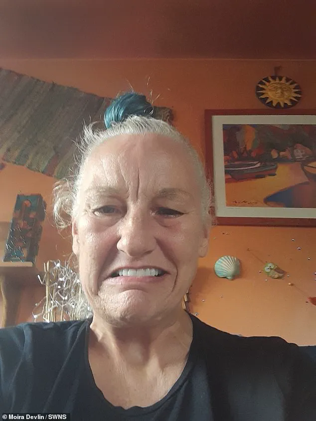 A Mother's Disfigurement: The Alarming Risks of Costly Dental Implants to Communities