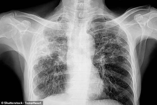 Silent Health Crisis: Link Between Chronic Lung Disease and Vision Loss Sparks Expert Warnings