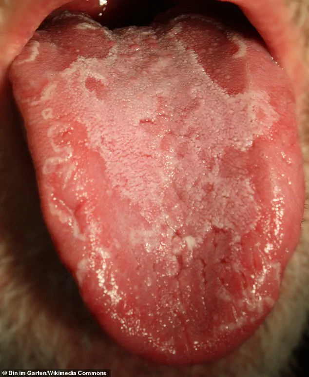 Kate McKinnon Reveals She Has Rare Tongue Condition: Geographic Tongue