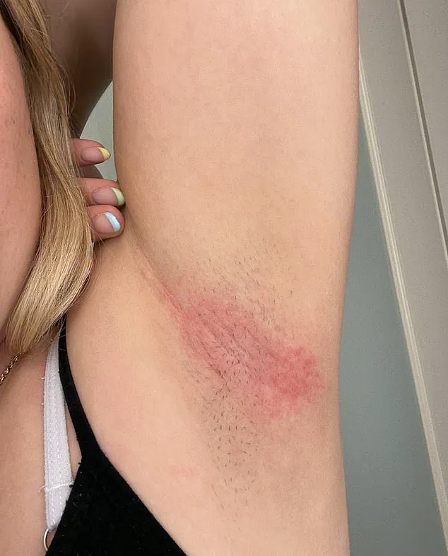 Mitchum's Deodorant Faces Fresh Complaints as Men Report Pain, Joining Women's Earlier Social Media Outcry Over Rashes and Burns