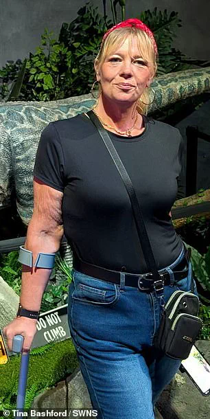 From Binge Eating to Severe Obesity: A Mother's Health Struggle