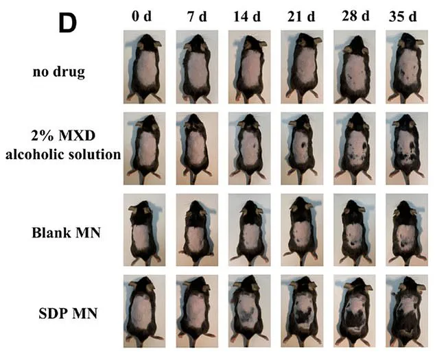 Stevia's Surprising Role in Hair Loss Discovery Sparks Regulatory and Public Health Discussions