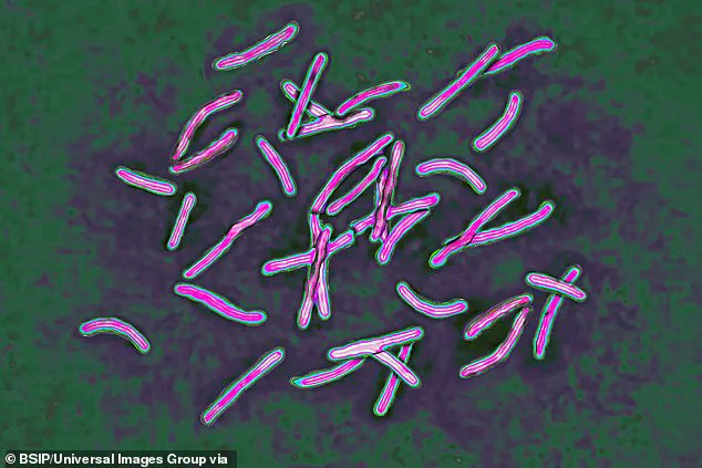Government Warns of TB Surge, Urges Public Action as Cases Rise 13.6% in England