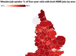 Government Warns of TB Surge, Urges Public Action as Cases Rise 13.6% in England