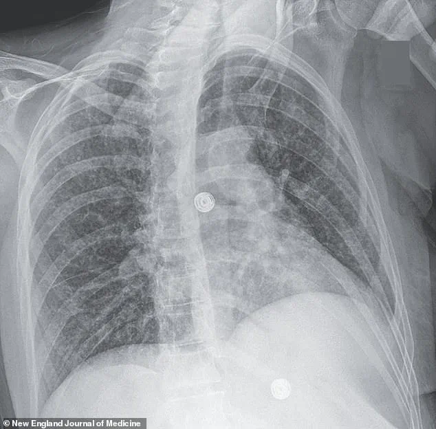 Mental Health and Infection Control: Expert Advisories on Integrated Public Health Strategies