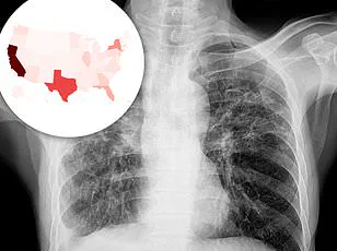 Mental Health and Infection Control: Expert Advisories on Integrated Public Health Strategies