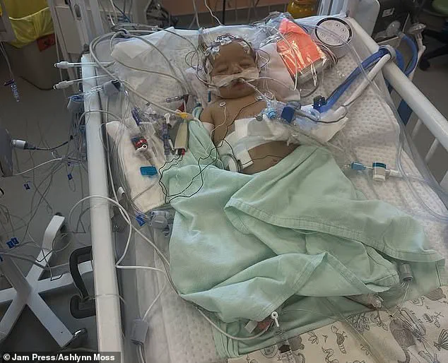 Newborn's Alarming Jaundice Sparks Urgent Call for Expert Medical Guidance and Public Awareness