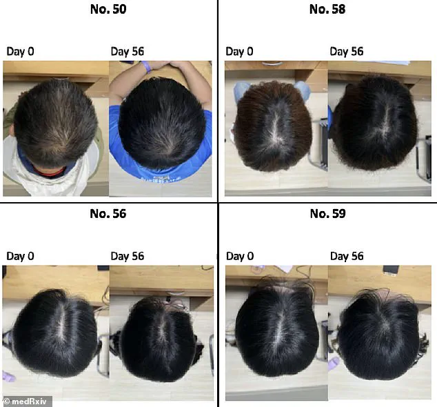 Ancient Wisdom and Modern Science Unite in Fight Against Hair Loss