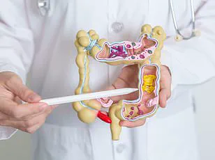 Blood in the Stool: James Rogers' Story on the Importance of Early Detection in Bowel Cancer