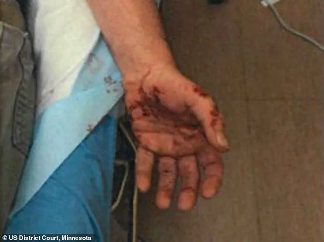 ICE Agent Jonathan Ross, Involved in Renee Good's Fatal Shooting, Details Previous Incident Where He Was Dragged 100 Yards by Suspect at 40mph, Sustaining Severe Scars