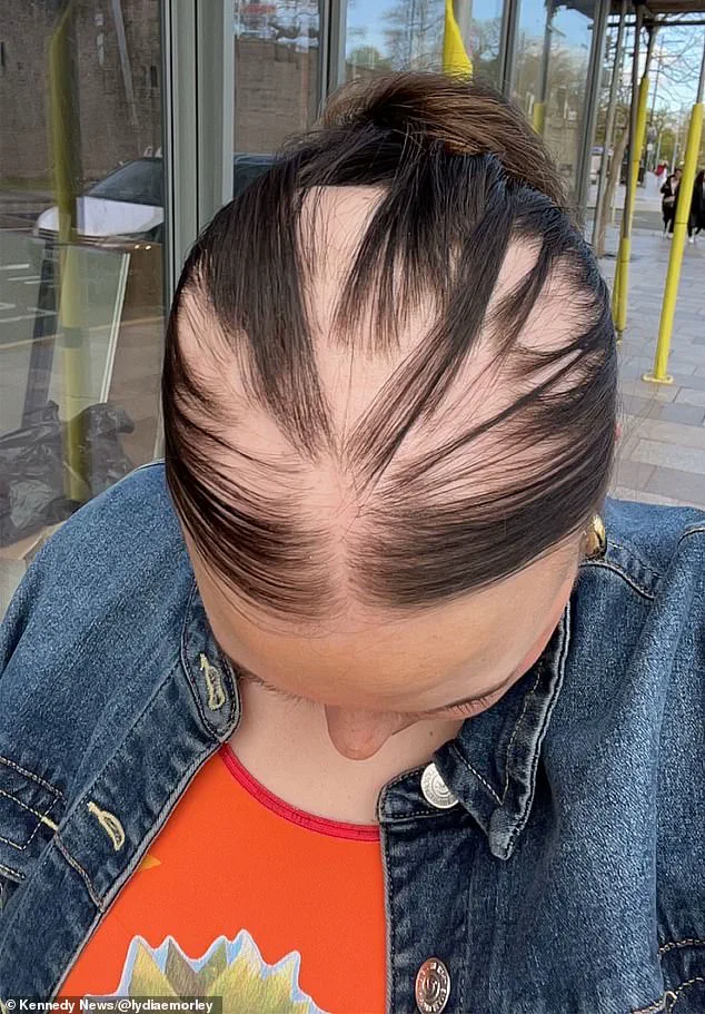 Could the Virus Have Left Lasting Immune Changes?