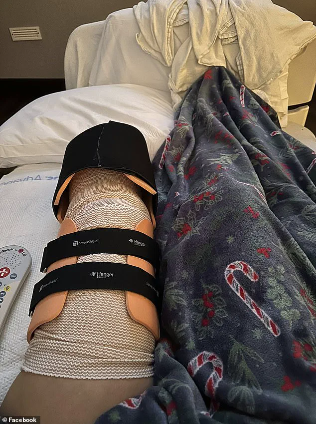 Amputation and Injuries in Pit Bull Attack Prompt Discussion on Dog Ownership and Regulation