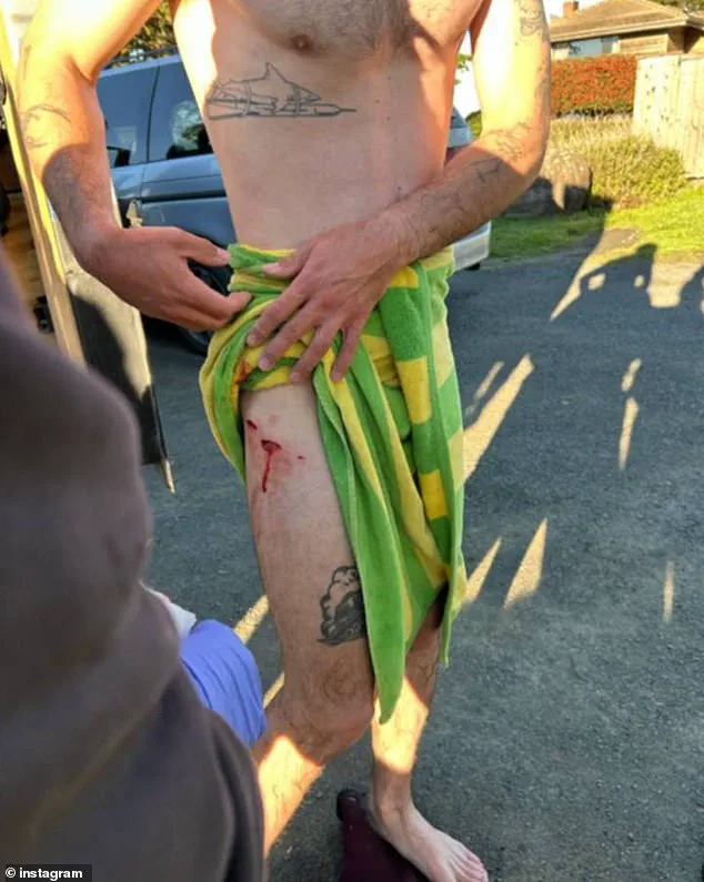 Surfer Survives Terrifying Shark Encounter Off California Coast