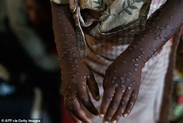 Climate Change and Globalization: Catalysts for Emerging Viral Threats