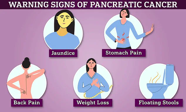 Advanced Pancreatic Cancer Diagnosed in Plasterer During Routine Check-Up