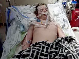 Doctors Warn OTC Benadryl Risks Outweigh Benefits in Allergy Medication Debate