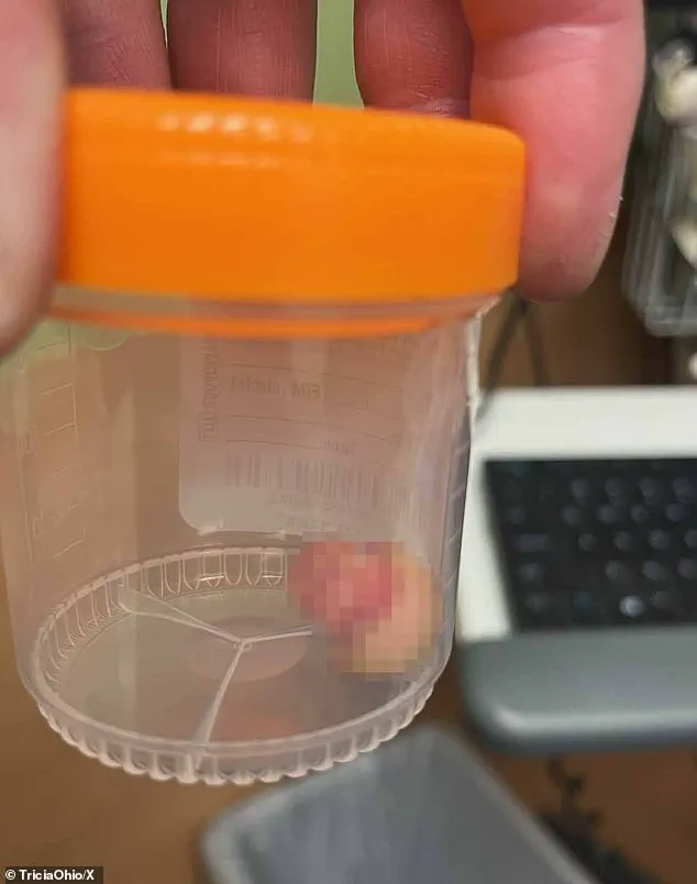 Minneapolis Reels After Federal Agents Shoot University of Minnesota Nurse in Violent Clashes