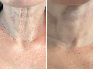 Surge in Hair Loss Among UK Women Sparks Concern and Calls for Answers