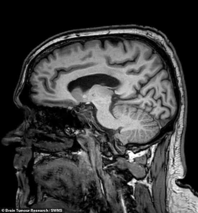 Overlooked Symptoms: How a Misdiagnosis Led to a Tragic Car Crash