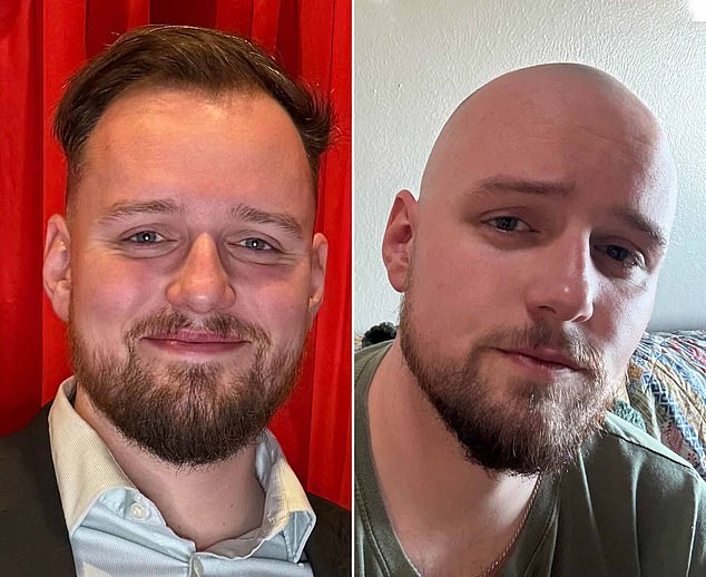 r/bald: A Digital Oasis of Encouragement and Positivity in the Fight Against Baldness