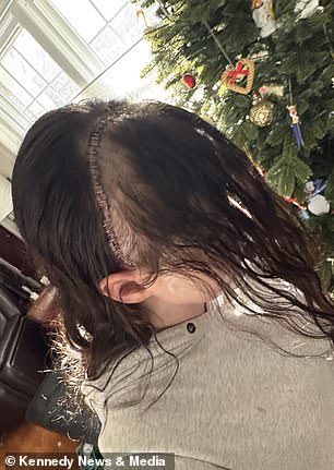 From Dismissal to Medical Crisis: Gillian Keating's Journey with Severe Headaches