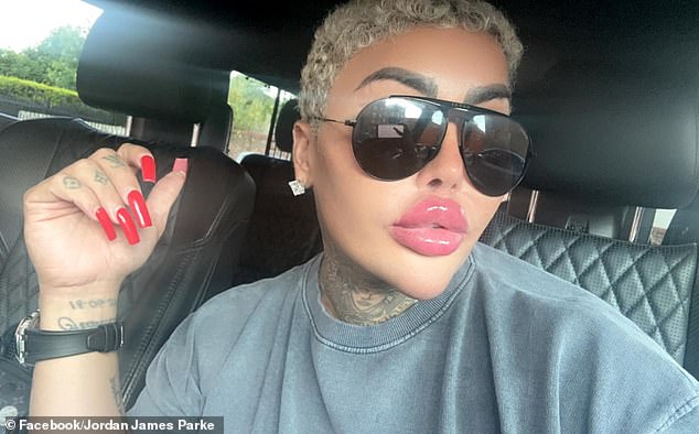 The Lip King's Sudden Death Leads to Manslaughter Charges and Calls for Beauty Industry Regulation