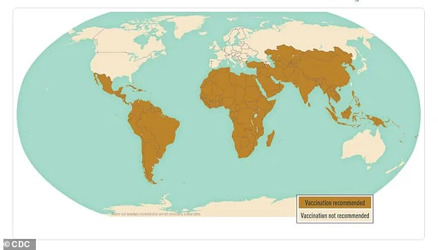 Drug-Resistant Typhoid Spreading Across Continents, Challenging Global Health Systems