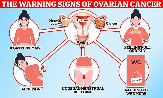 Ovarian Cancer: Early Detection Could Save Thousands of Lives