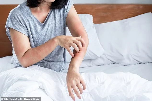 Dust Mites: Tiny Invaders with a Major Impact on Health