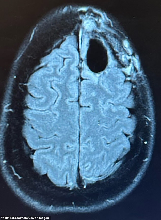 Chicago Mother Diagnosed with Aggressive Brain Tumor Just Months After Giving Birth