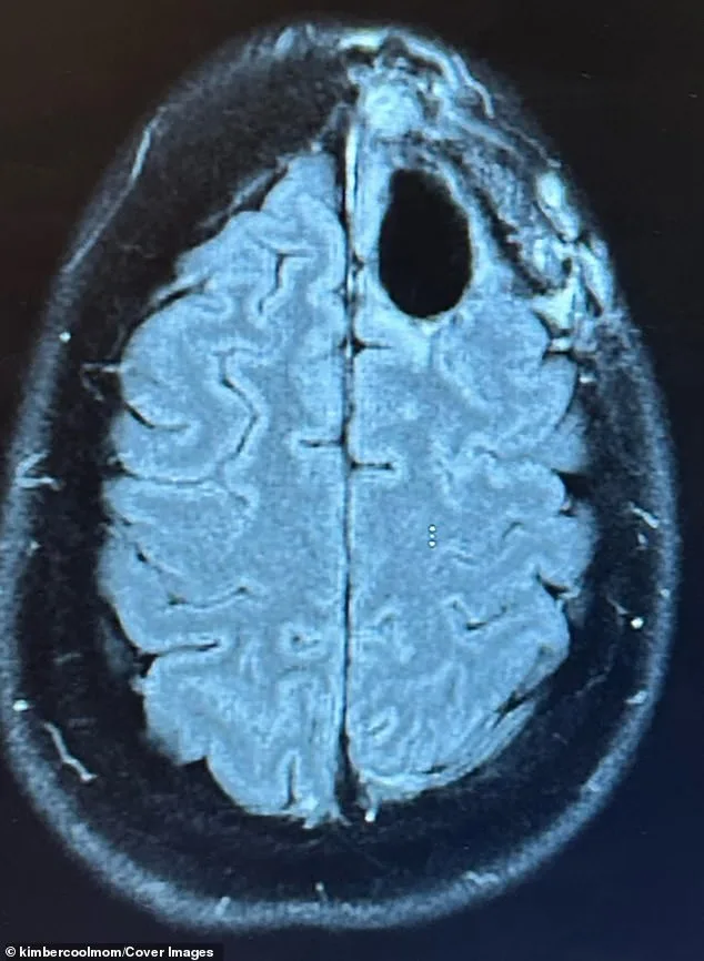 Chicago Mother Diagnosed with Aggressive Brain Tumor Just Months After Giving Birth