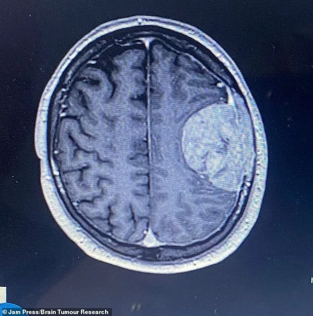 From Migraines to Brain Tumour: A Swansea Family's Desperate Fight