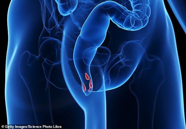 The Hidden Habit: How a Simple Daily Routine Can Alleviate Hemorrhoids—or Harm Others