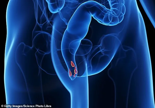 The Hidden Habit: How a Simple Daily Routine Can Alleviate Hemorrhoids—or Harm Others