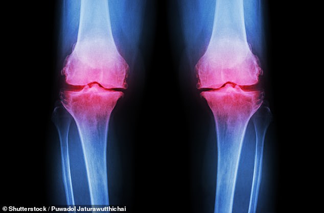 Low-Cost Prebiotic Fibre Shows Promise as Alternative to Pharmaceuticals for Osteoarthritis Pain
