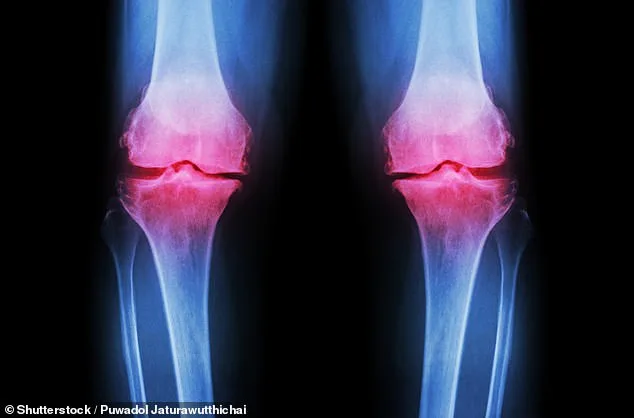 Low-Cost Prebiotic Fibre Shows Promise as Alternative to Pharmaceuticals for Osteoarthritis Pain