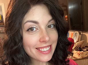 When Burnout Became Lupus: A Student's Path from Ignored Symptoms to Diagnosis