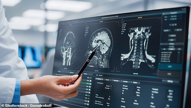 When Headaches Signal Danger: 4 Red Flags That Could Save Your Life