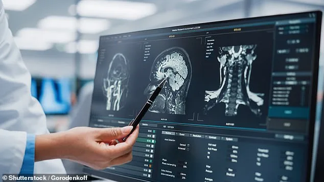 When Headaches Signal Danger: 4 Red Flags That Could Save Your Life