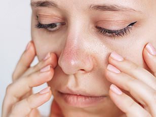 Mounjaro: Weight-Loss Success Comes with Nausea and Hair Loss Side Effects