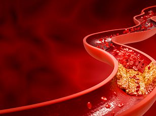 11 Extra Minutes of Sleep May Lower Heart Attack Risk, Study Finds