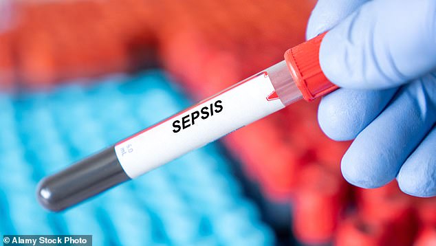 A Systemic Failure: How Endometriosis and Post-Surgery Complications Expose Gaps in UK Healthcare