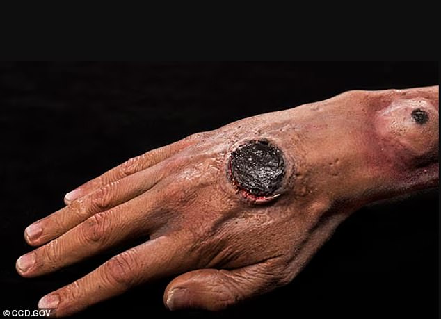 Deadly Anthrax Bacteria Found in Soil Across 43 States, Scientists Warn of Risk