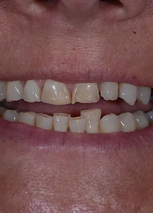 From Hidden Smiles to Confidence: How the ABC Technique Transformed Mandy Turver's Life