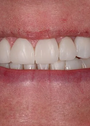 From Hidden Smiles to Confidence: How the ABC Technique Transformed Mandy Turver's Life