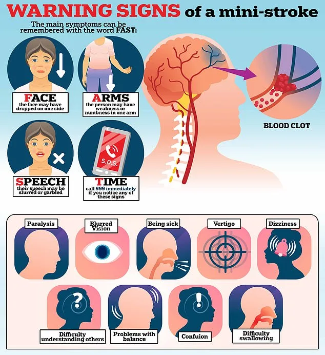 Mini Strokes: Critical Warning Sign for Imminent Stroke, Experts Warn