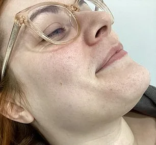 More Than a Cosmetic Issue: The Hormonal Journey of Women Dealing with Hirsutism in the UK